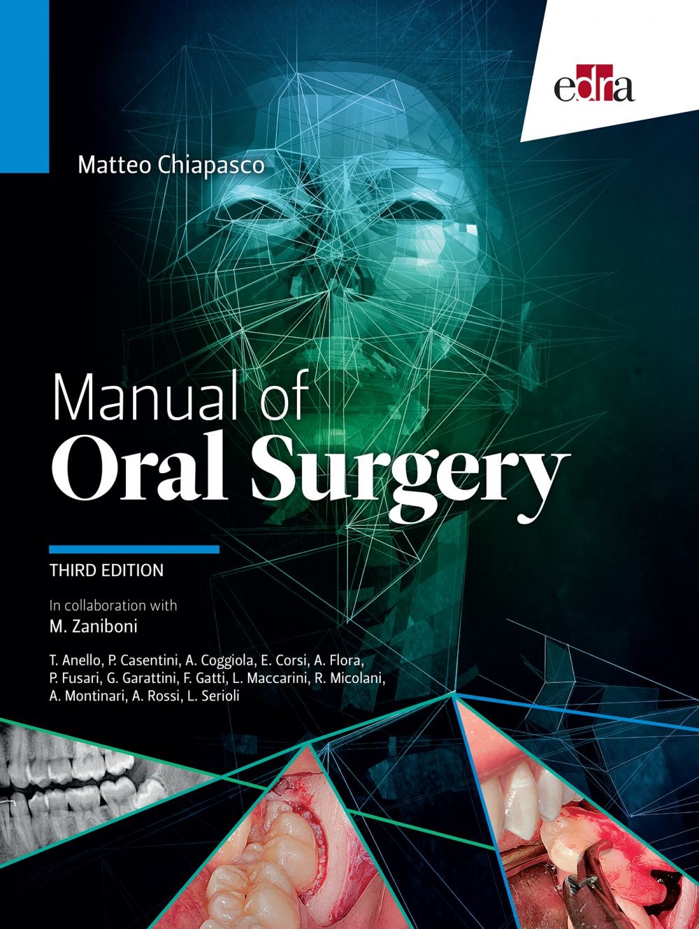view management in neuro