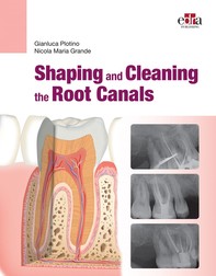 Shaping and  Cleaning the Root Canals - Librerie.coop