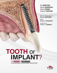 Tooth or Implant? - Librerie.coop