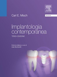 Implantologia contemporanea - Librerie.coop