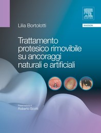 Trattamento protesico rimovibile su ancoraggi naturali e artificiali - Librerie.coop