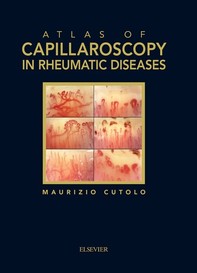 Atlas of capillaroscopy in rheumatic diseases - Librerie.coop