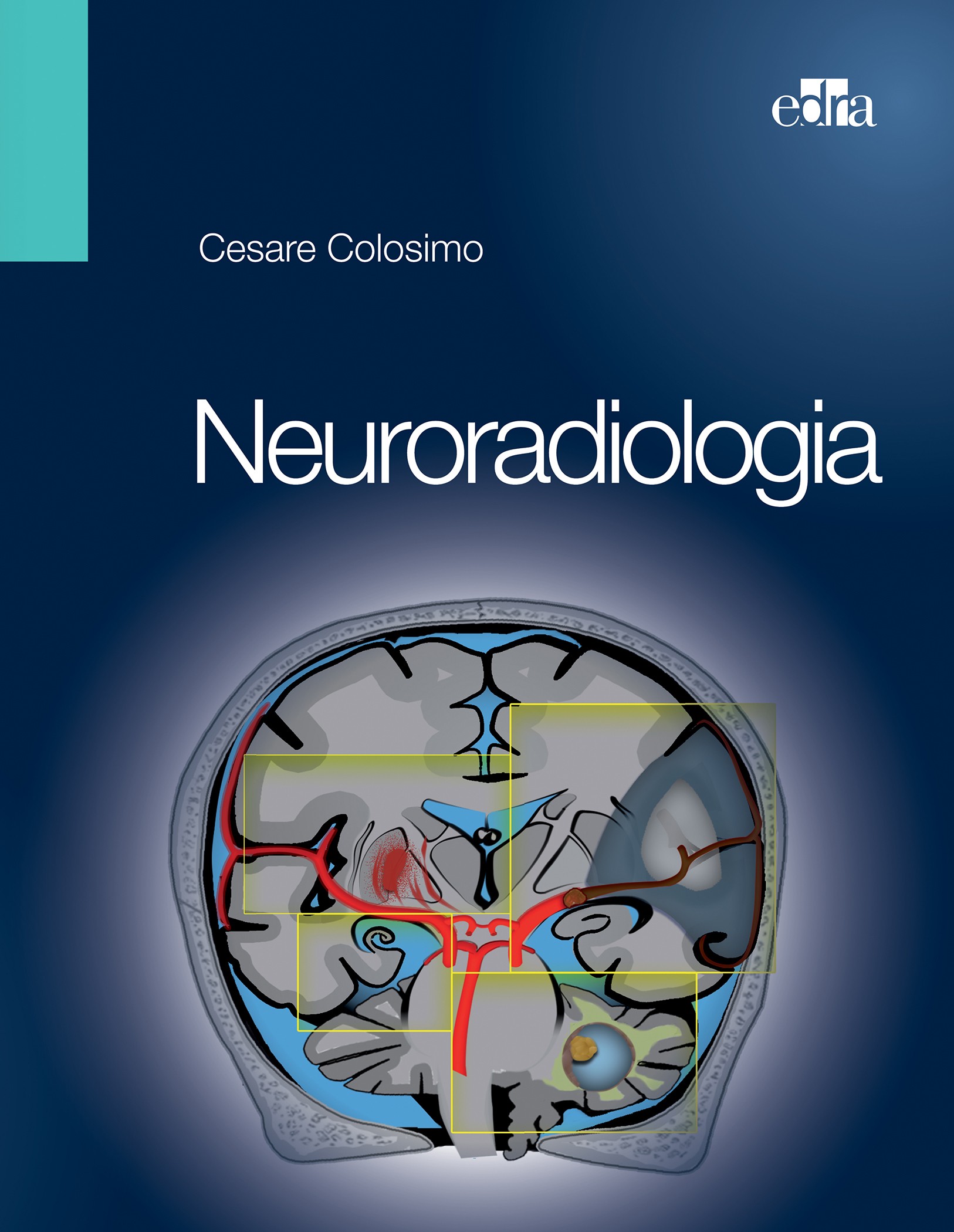 Neuroradiologia - Librerie.coop
