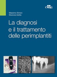 La diagnosi e il trattamento delle perimplantiti - Librerie.coop