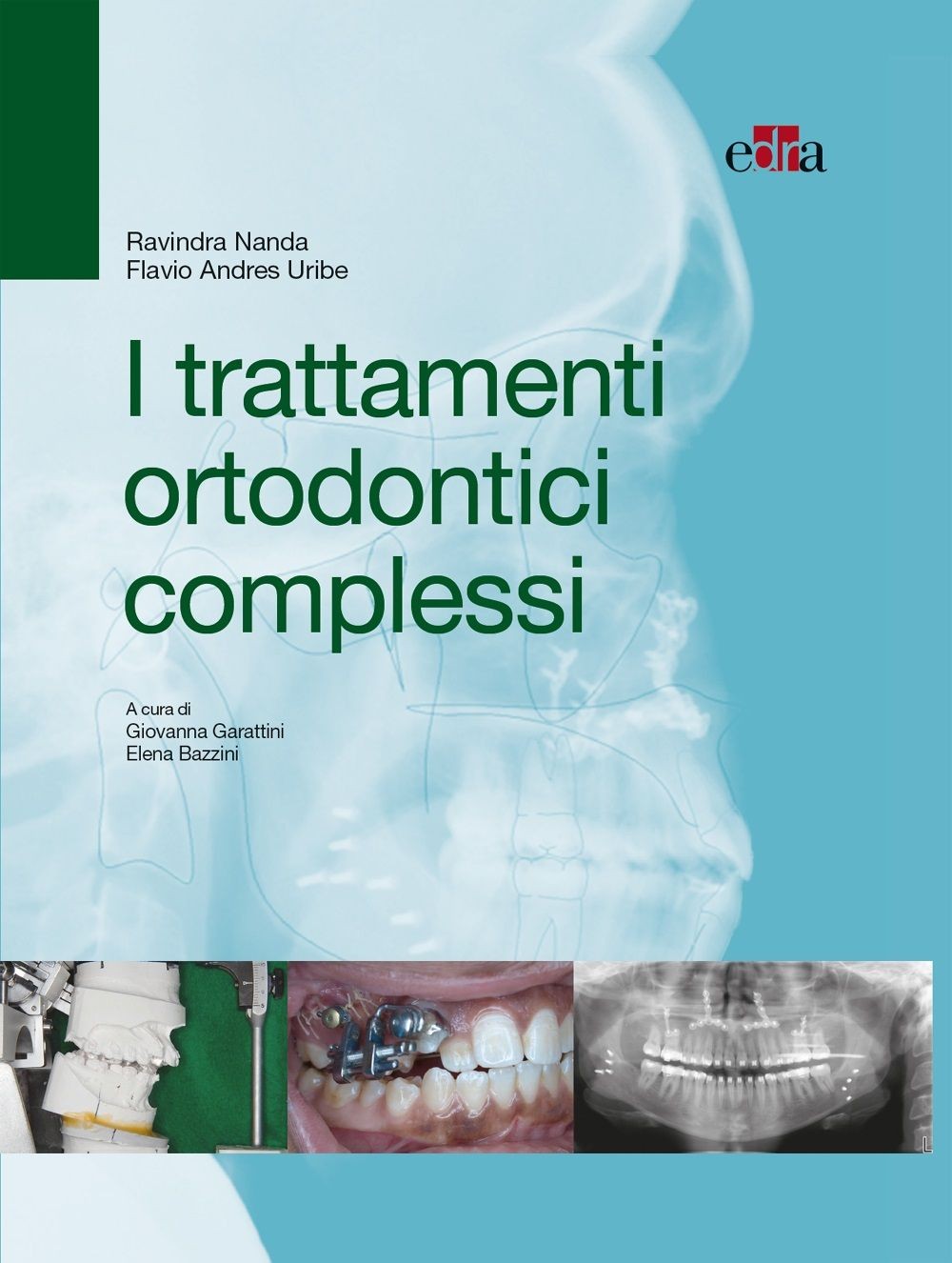 I trattamenti ortodontici complessi - Librerie.coop