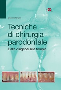 Tecniche di chirurgia parodontale - Librerie.coop