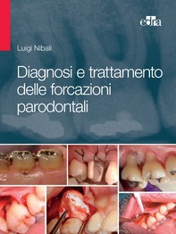 Diagnosi e trattamento delle forcazioni parodontali - Librerie.coop