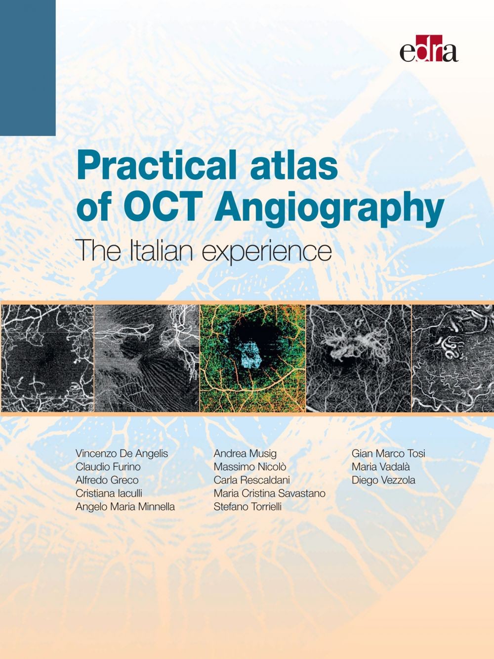 Practical atlas of OCT Angiography - Librerie.coop