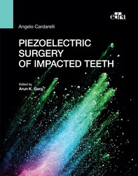 Piezoelectric surgery of impacted teeth - Librerie.coop