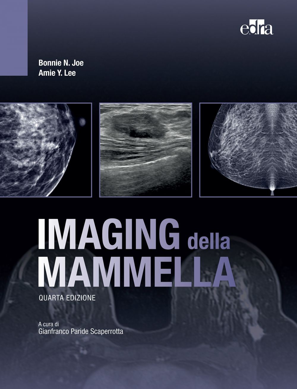 Imaging della mammella, 4 ed. - Librerie.coop