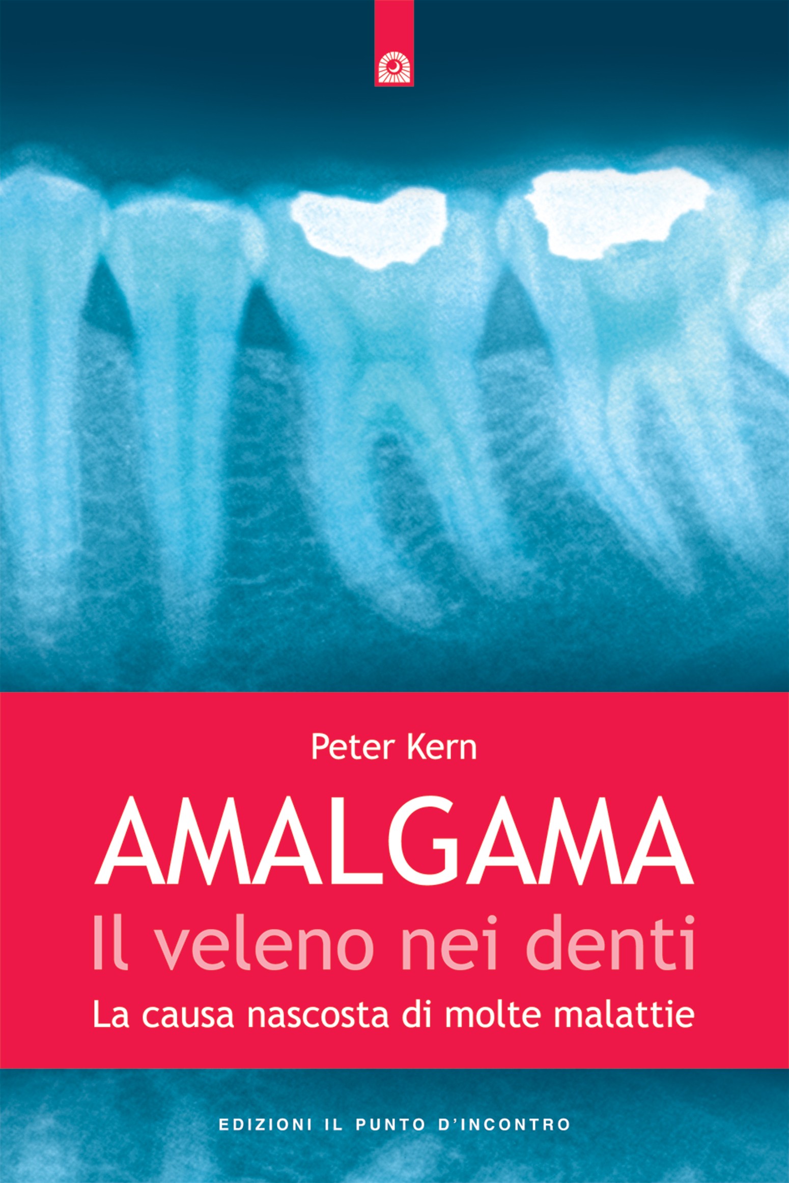 Amalgama: il veleno nei denti - Librerie.coop