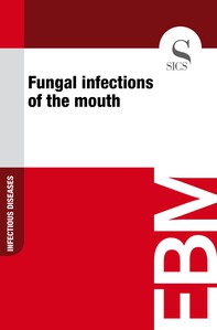 Fungal Infections of the Mouth - Librerie.coop