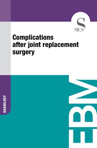 Complications After Joint Replacement Surgery - Librerie.coop