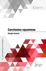 Carcinoma squamoso - Librerie.coop