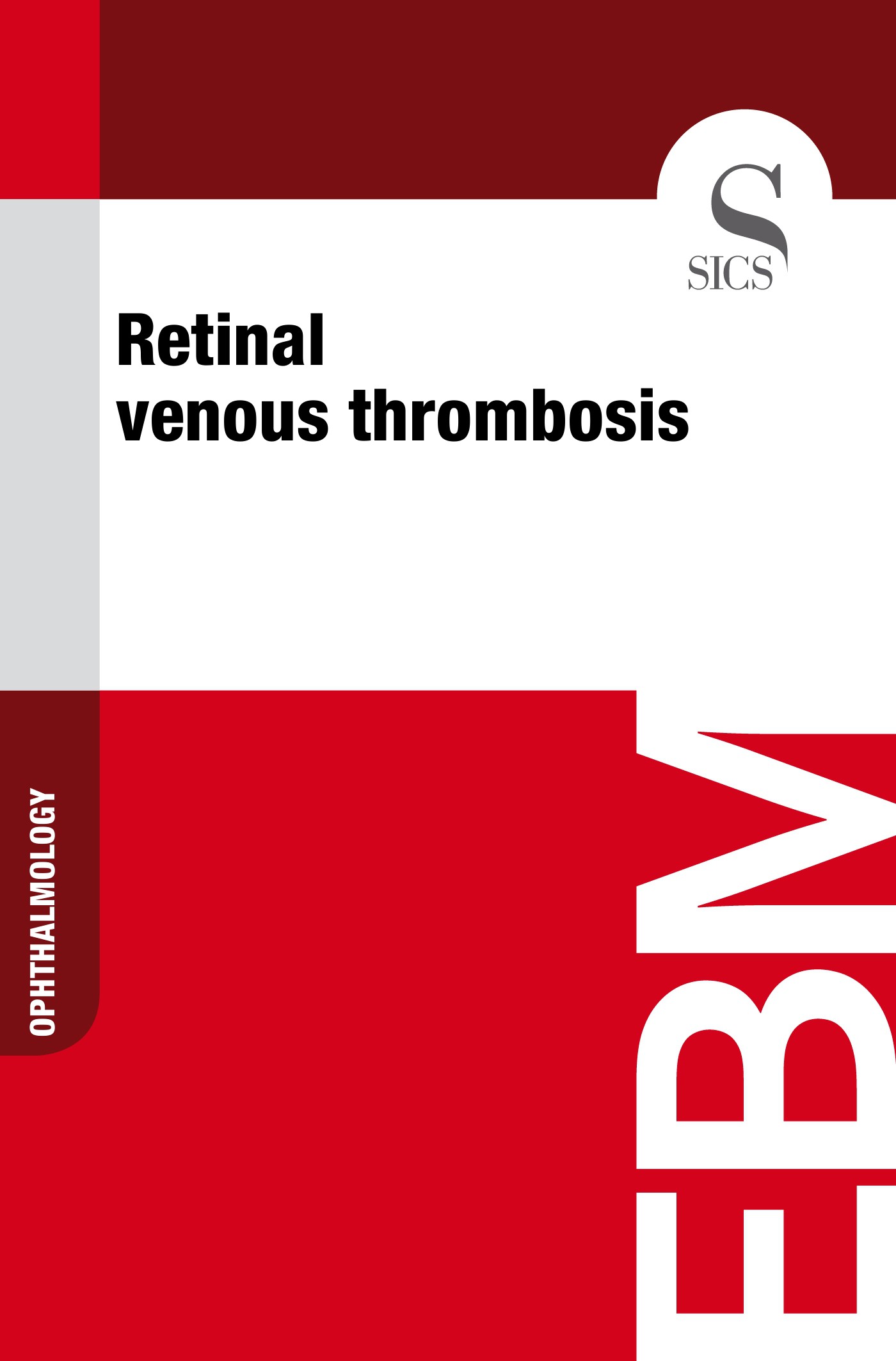 Retinal Venous Thrombosis - Librerie.coop