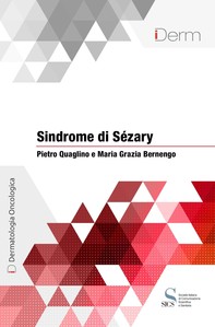 Sindrome di Sézary - Librerie.coop