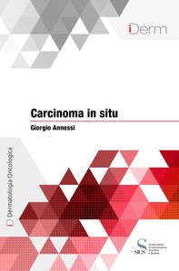 Carcinoma in situ - Librerie.coop