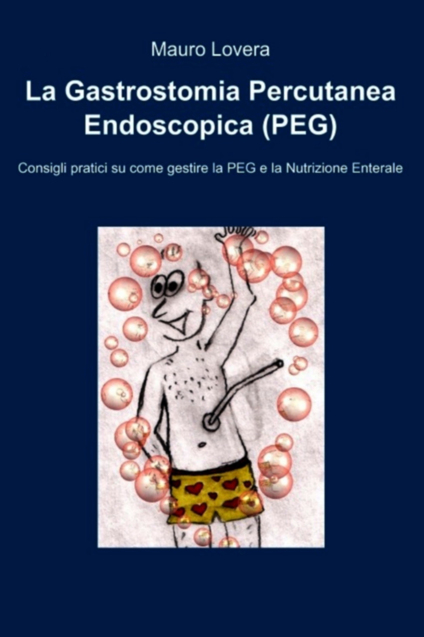 La Gastrostomia Percutanea Endoscopica (PEG) - Librerie.coop